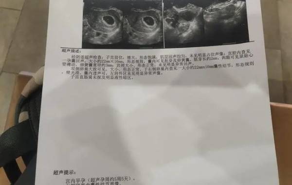 从孕囊的2个数据看性别不准