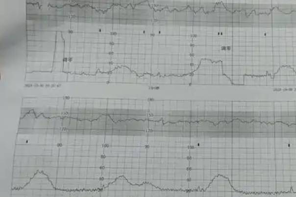 胎动异常要立即就医