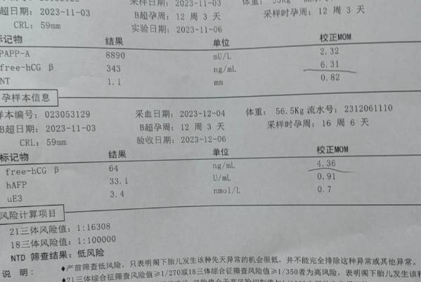 唐氏筛查期间作息要规律