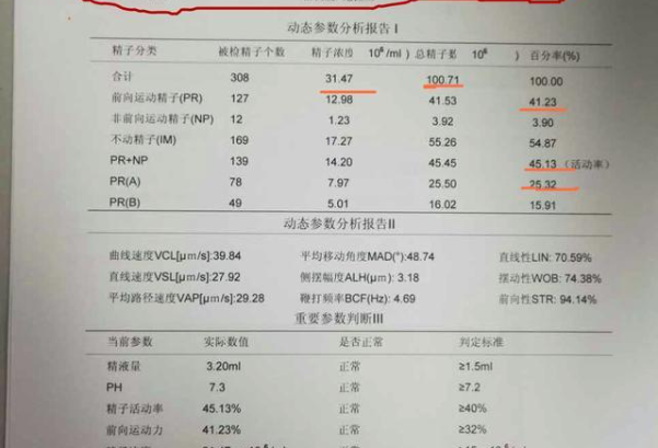 一文教你怎么看精子检查报告单，重点关注这几个数值