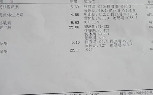 雌二醇水平越高卵泡质量不一定好