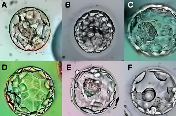 根据试管胚胎等级划分来看6天的囊胚4bb质量怎么样？