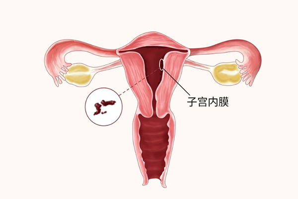 内膜变薄和内分泌失调有关