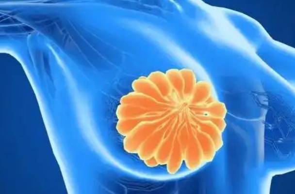 在医院被确诊为乳腺结节4b级必须要通过手术治疗吗？