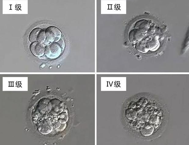 试管移植D3等级的冻胚最迟几天着床比较正常?