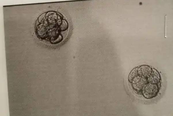 高龄女性可以移植冻胚